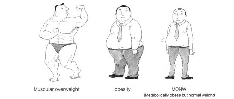 근육발달 과체중, 비만, 마른비만